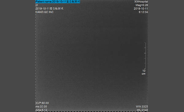 Good Quality of X-Ray Imaging